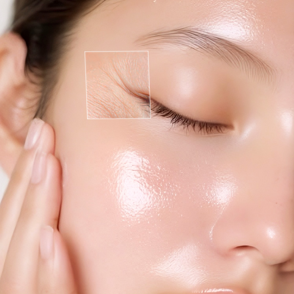 TTM001 – Xóa nhăn mí mắt