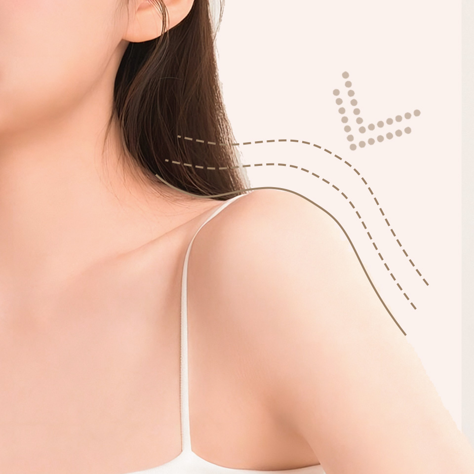 TTM006 – Tiêm thon cầu vai