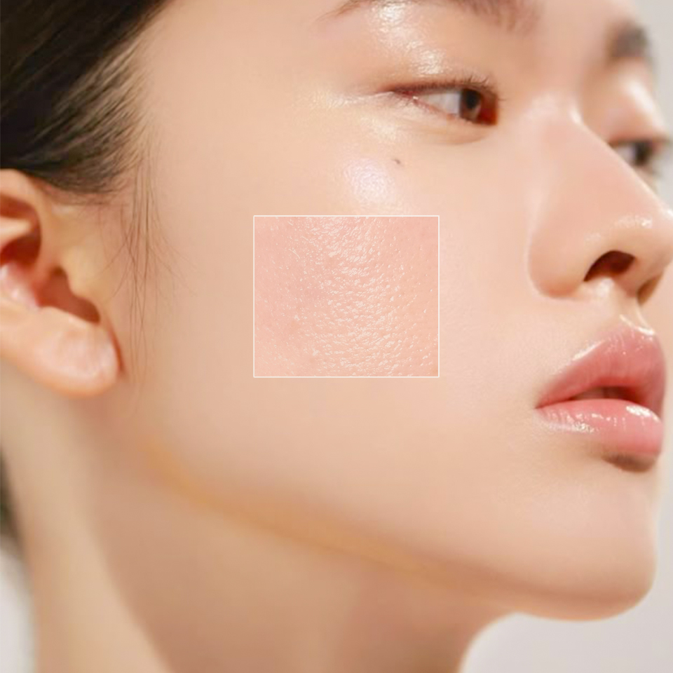 CSD002 – Liệu trình da dầu, mụn