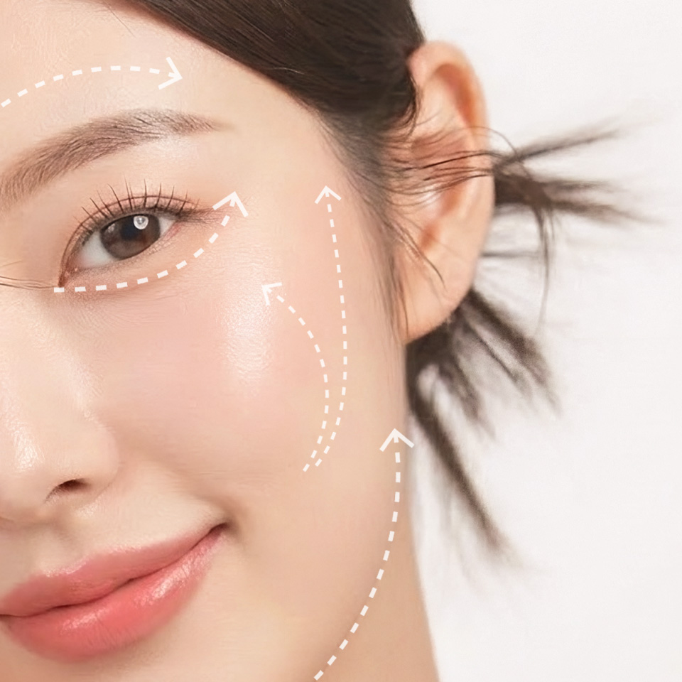 TTM007 – Filler Hàn Quốc