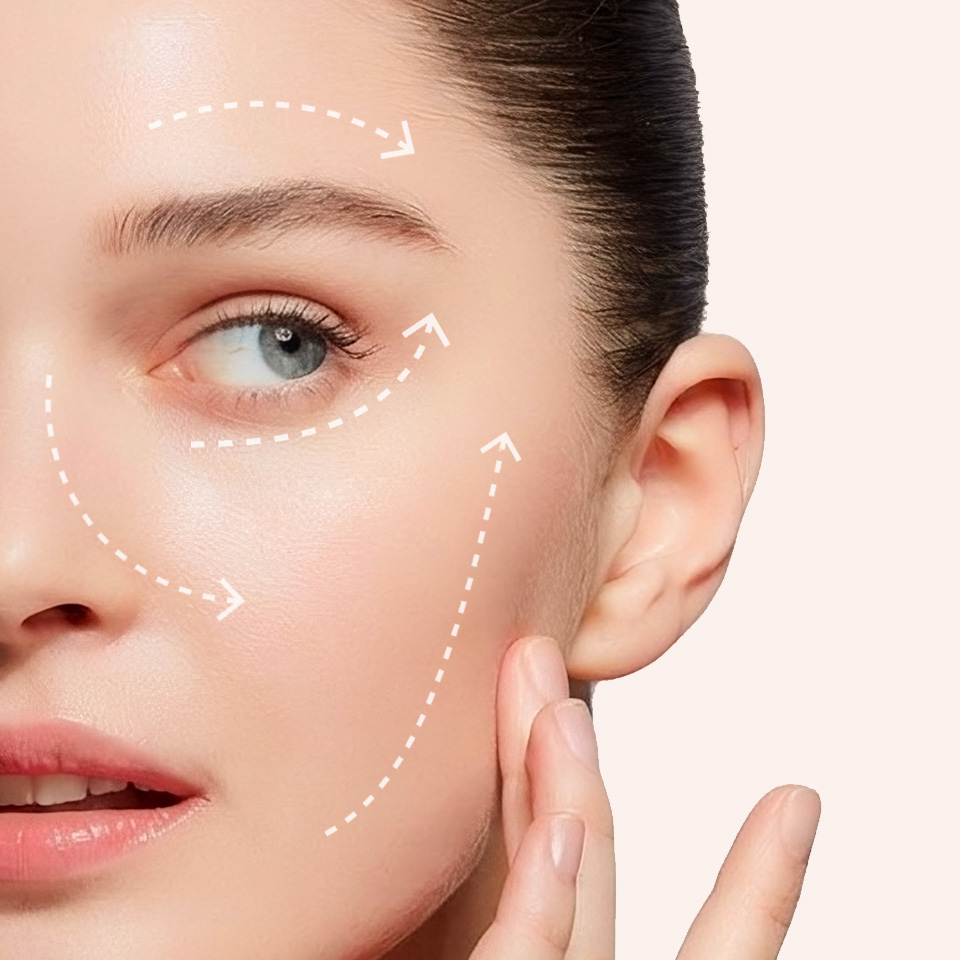 TTM008 – Filler Châu Âu