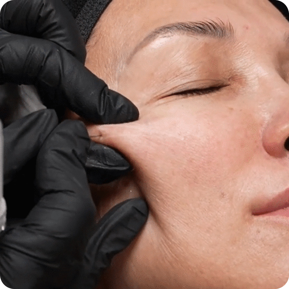 Cải thiện sắc tố da