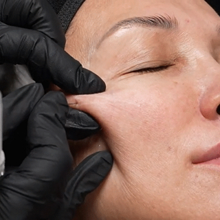 Cấy DNA cá hồi – Phương pháp làm đẹp thần thánh được ưa chuộng