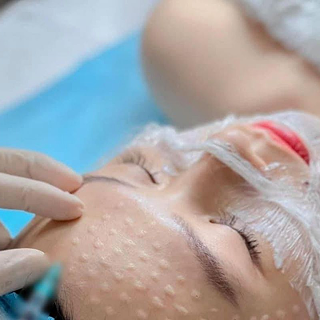 Salmon DNA injection – A miraculous and popular beauty treatment.